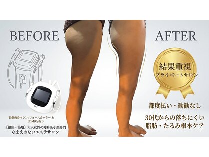 なまえのないエステサロンの写真