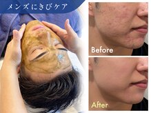 オーシャンブルー 大分店(OCEAN BLUE)