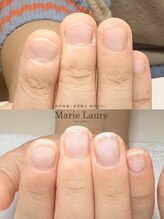 マリーロール 梅田店(Marie Laure)/自爪育成/深爪矯正/ネイルケア