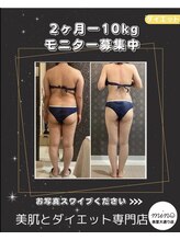 ミノ 美里大通り店(mino)/ダイエットパッケージ