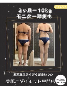 ミノ 美里大通り店(mino)/ダイエットパッケージ