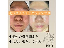 カメリア(camelia)の雰囲気（毛穴が綺麗に！美容液が浸透し易く、お肌悩み改善。化粧崩れ改善）