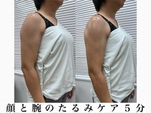 カイロプラクティック ネクサス/顔と腕のむくみ撃退◇