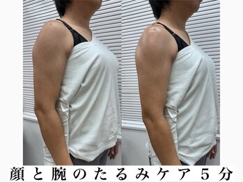 カイロプラクティック ネクサス/顔と腕のむくみ撃退◇