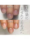 小さい爪が確実に変化！