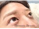 ブロッサムビューティー(Blossom Beauty)の写真