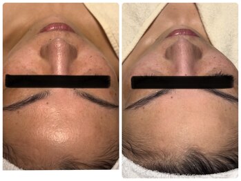 ベルドア(Bell Door)/肌の活力を底上げ♪