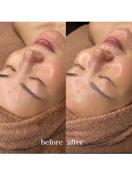 ルミナス(Luminous)/ララピール