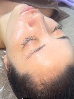 アンドエラ(&ERA)の写真/【頭×顔】リアボーテから待望のヘッドスパ！お顔の筋肉膜を元の場所に戻しフェイスラインを引き締める！