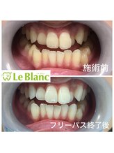 ルブラン 奈良店(Le Blanc)/老若男女問わず人気です！