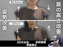 骨盤矯正初回施術/恵比寿/渋谷/小顔/小顔矯正/骨盤矯正/肩こり