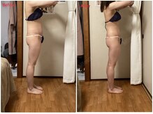 ミュー 新小岩店(Mieux)/ハイパーナイフEX1回効果