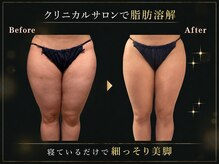 リオ(Rio)の雰囲気（脂肪コントロール認定サロン☆全身可◎【滋賀/草津/たるみ】）