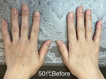 桃の木 吉祥寺店/５０代お薦め　ハリ弾力アップ