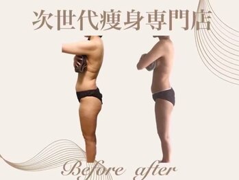 グロワール(gloire)/◇BeforeAfter◇