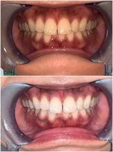 ライトビューティー 池袋店(LightBeauty)/症例写真