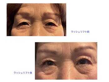 ベルプラーナ(Bellpurana)/ケラチンラシュリフト