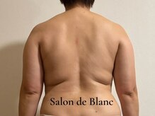 サロン ド ブラン(Salon de Blanc)