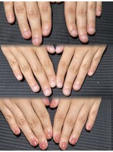 リリ(Rili)/深爪矯正 自爪育成