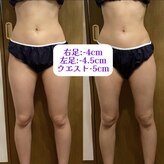 トゥルーボーン(true born)