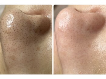 ルルドアージュ(luludoor-ge)/二刀流エクストラクション