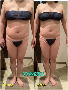 クレアボディ(CREA BODY)/3D骨格矯正