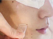 ホワイトニングショップ 町田店/【韓国式3D毛穴洗浄】汚れ取れる