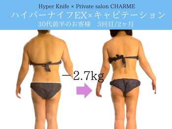 シャルム(charme)/ハイパーナイフEX痩身