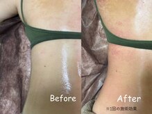 ボディーリセット 勝どき/【before/after】エステ・痩身