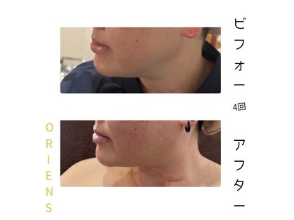 オリエンス(oriens)の写真