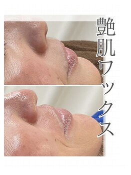 バーグトータルビューティー(bague total beauty)/艶肌ワックスでお肌トーンアップ