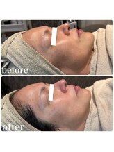 ディオーネ 春日井勝川店(Dione)/マーメイドセルトリートメント