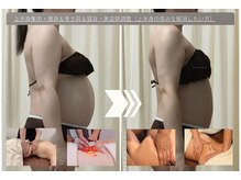 ルノン(Lunon)/上半身・痩身＆巻き肩＆猫背調整