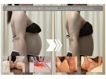 ルノン(Lunon)/上半身・痩身＆巻き肩＆猫背調整