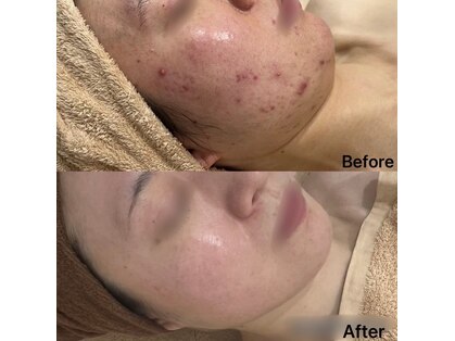 リンダ(Rinda)の写真