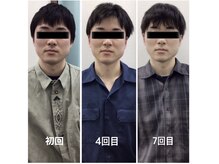 サロン ナウ オア ネバー(Salon Now or Never)の雰囲気（男性の小顔、猫背改善もおまかせ下さい！(メニュー:小顔矯正)）