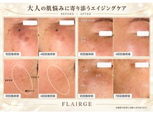 フレアージュ