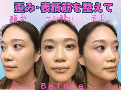 ナチュラルパーフェクトフェイス 新宿の写真