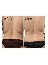 ライフタイム(LifeTime)/