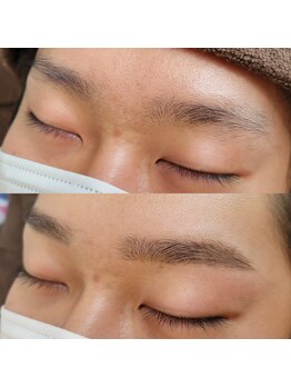 顔肌革命 ビューティアンドヘルス バイ メール(beauty&health by mer)/眉毛ワックス脱毛