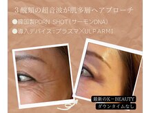 小顔ウナ学芸大学店(UNA)