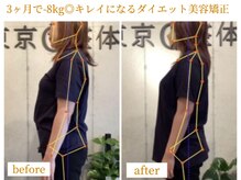 東京G整体/ダイエットビフォーアフター