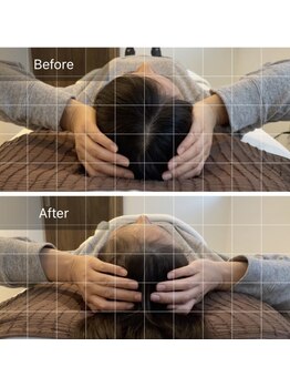 ヴィシャイン(vi shine)/あなたの頭のサイズは？