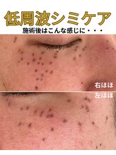 ココロ(COCORO)/他店より濃く反応すると・・・