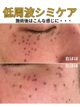 ココロ(COCORO)/他店より濃く反応すると・・・