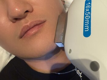 トータルビューティーサロン ルース(LUZ)の写真/【圧倒的抜け感！】VIO・ヒゲ脱毛に★Wax×光のW脱毛で徹底アプローチ！清潔感のある理想の美肌へ♪