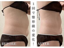 リアレント 高槻店(Lialent)の雰囲気（癒されながら綺麗に♪）