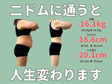 ニドム