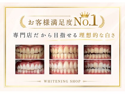 ホワイトニングショップ 長野店の写真