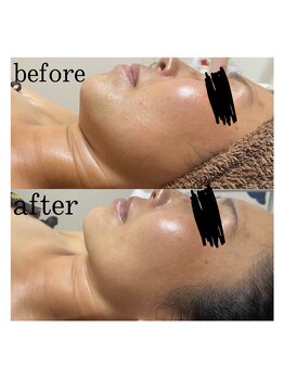 フェザー(feather)/タラソトリートメントの効果